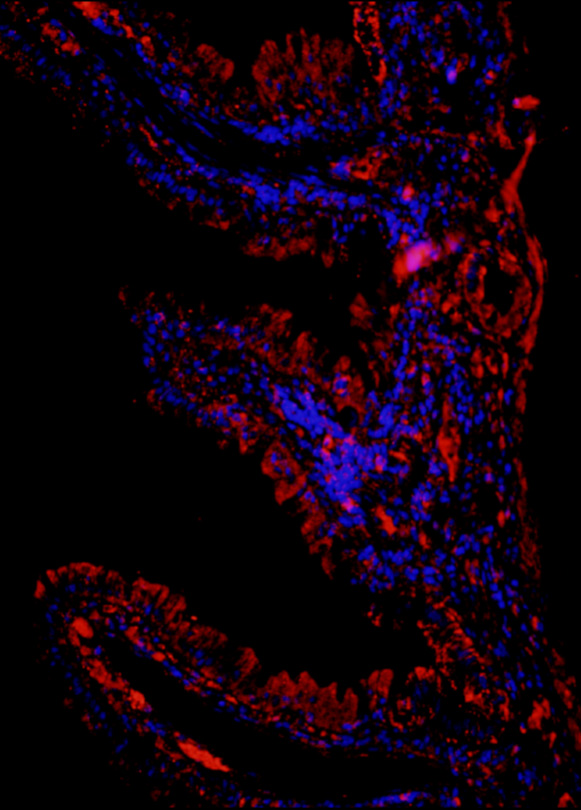 Read more about the article Novel regenerative peptide TP508 mitigates radiation-induced gastrointestinal damage by activating stem cells and preserving crypt integrity